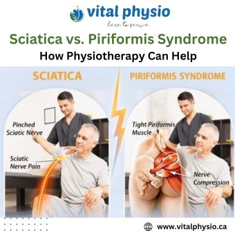Sciatica vs. Piriformis Syndrome How Physiotherapy Can Help